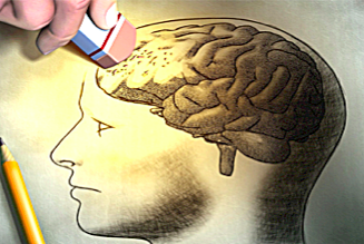 Hand holding an eraser rubbing out part of a pencil drawing of a human brain, symbolizing memory loss or forgetting